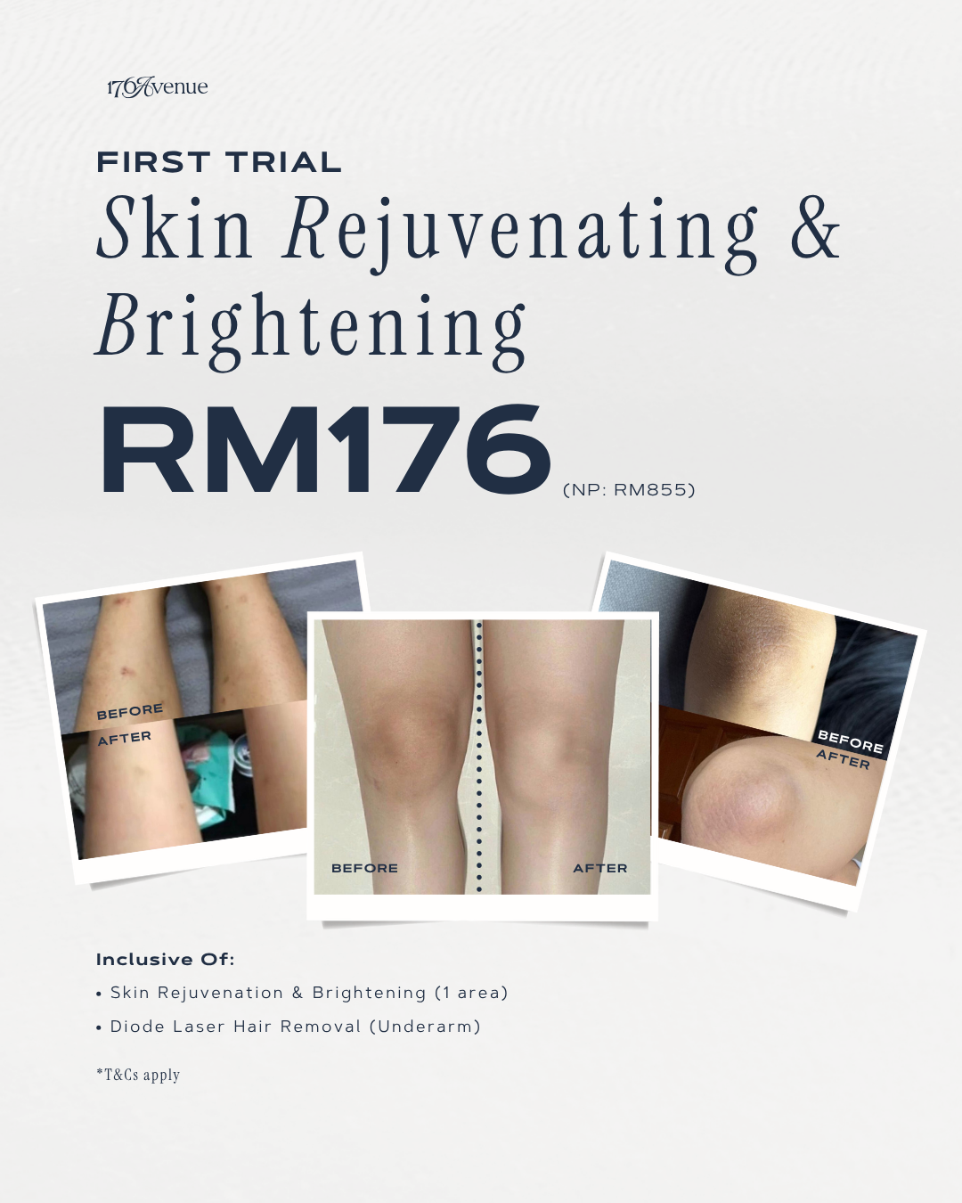 SKIN REJUVENATION & BRIGHTENING (First Trial)🤩