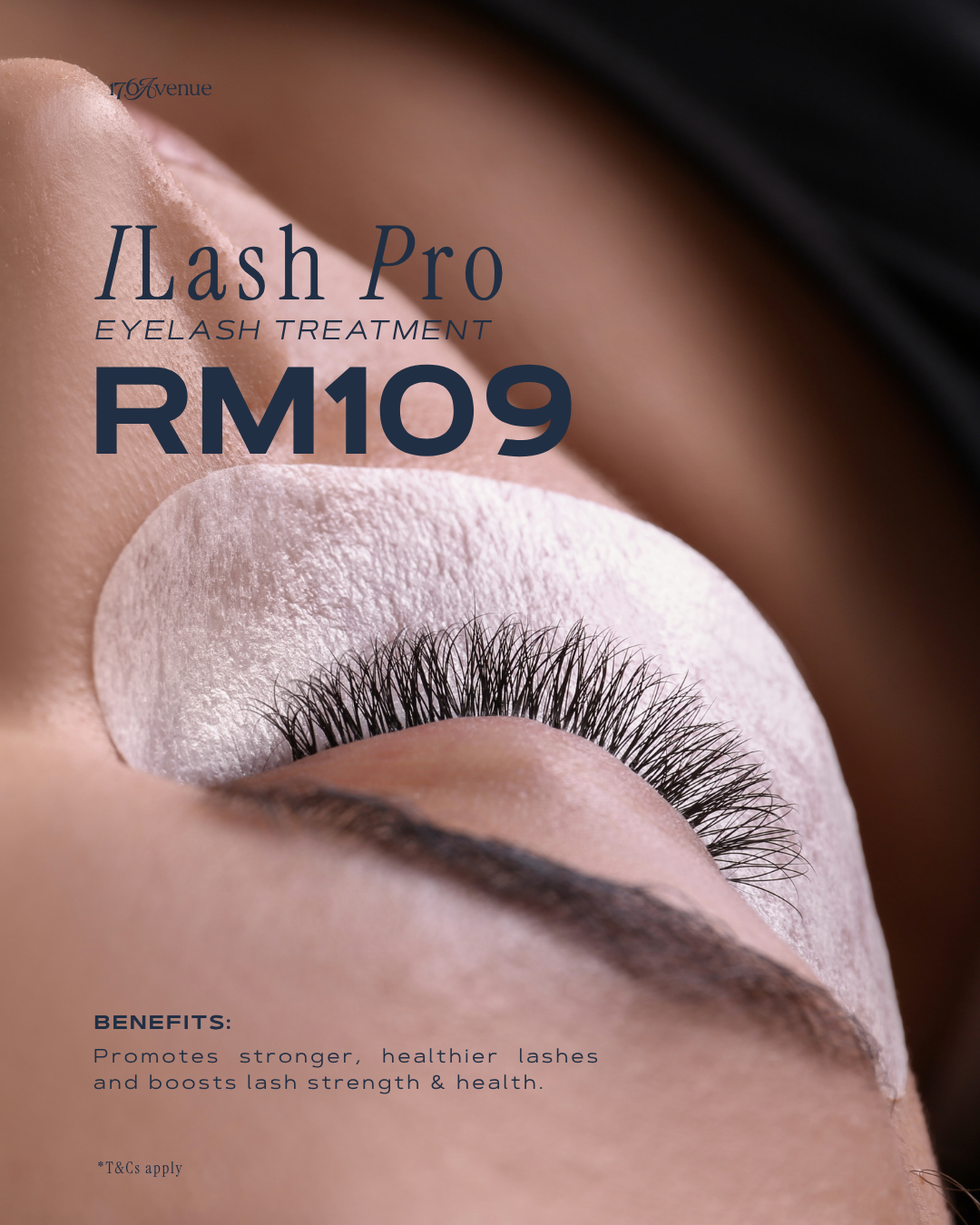 PRE-iLASH TREATMENT (First Trial)✨